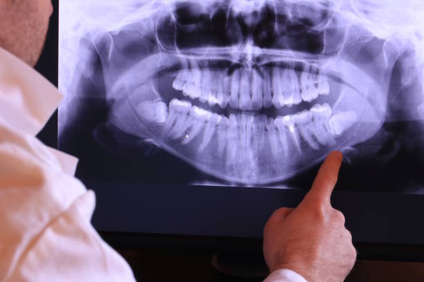 Best Emergency Treatment for Dental Infections or Abscesses in Marion, OH